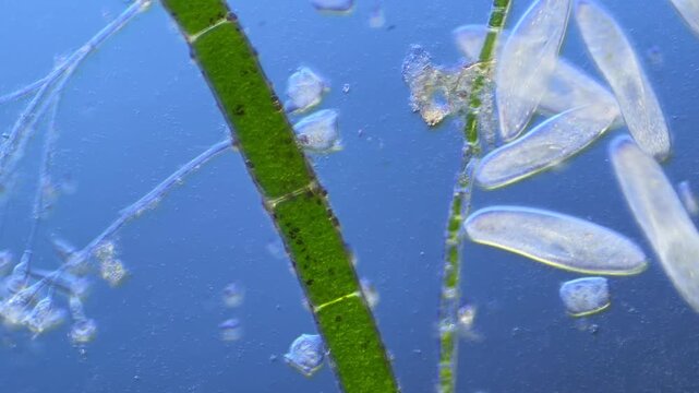 Numerous microorganisms under the microscope