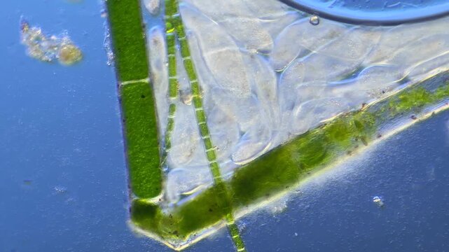 Numerous microorganisms under the microscope