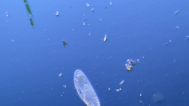 Paramecium and other microorganisms under the microscope at 100x Magnification