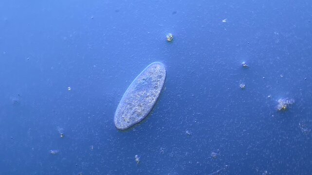 Paramecium and other microorganisms under the microscope at 100x Magnification