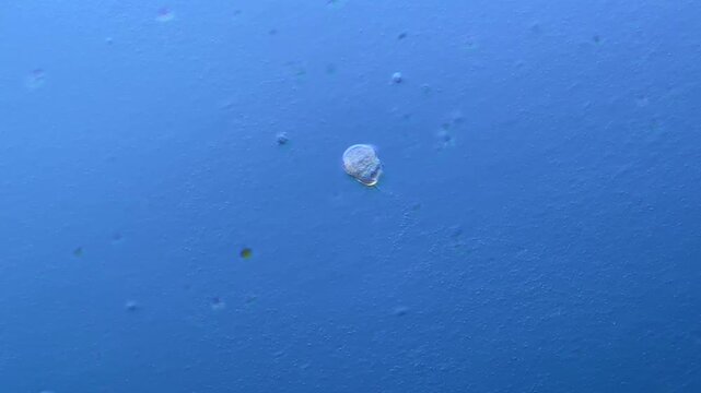 Paramecium and other microorganisms under the microscope at 100x Magnification