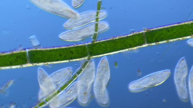 Numerous microorganisms under the microscope