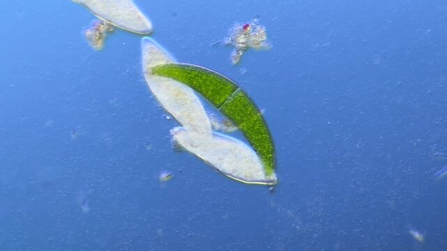 Paramecium and Closterium under the microscope at 100x Magnification