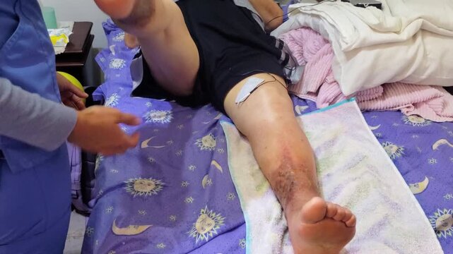 Close-up professional using electro-stimulation equipment on patient's leg for pain relief and rehabilitation in a private home setting.
