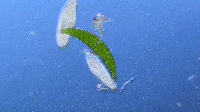 Paramecium and Closterium under the microscope at 100x Magnification