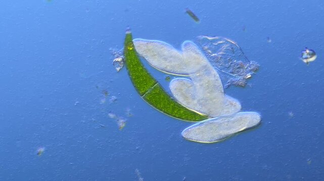 Paramecium and Closterium under the microscope at 100x Magnification