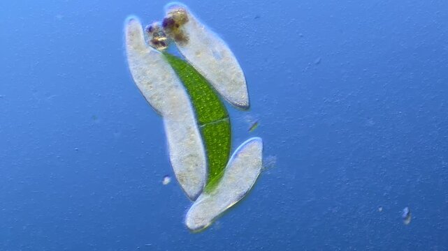 Paramecium and Closterium under the microscope at 100x Magnification