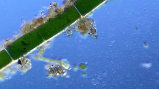 Paramecium and Closterium under the microscope at 100x Magnification