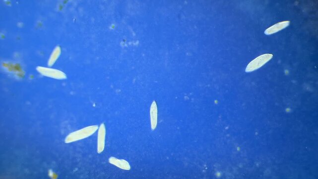 Large number of Paramecium under the microscope at 40x Magnification