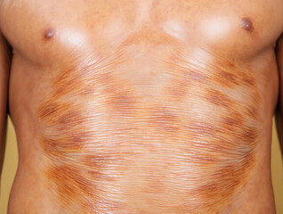 Fototapeta premium Progeria Close up of wrinkled skin with brown marks on chest texture