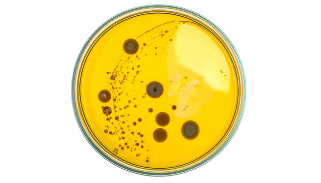 Close-up of petri dish with yellow agar and bacterial colonies