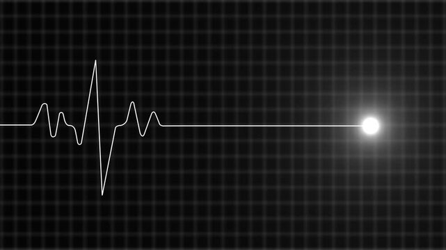E C G heartbeat pulse line graph on black background with grid pattern medical rhythm monitoring