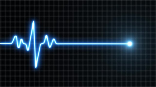 Blue E C G heartbeat line on black grid background medical technology concept