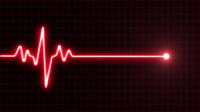 Electrocardiogram heartbeat pulse line graph on dark background with grid pattern medical health technology concept