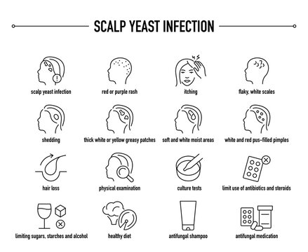 Scalp Yeast Infection symptoms, diagnostic and treatment vector icon set