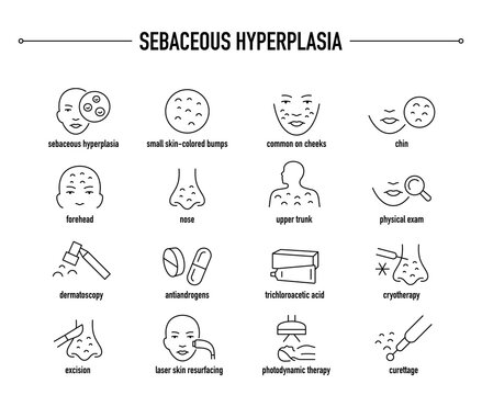 Sebaceous Hyperplasia symptoms, diagnostic and treatment vector icon set