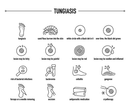 Tungiasis symptoms, diagnostic and treatment vector icon set