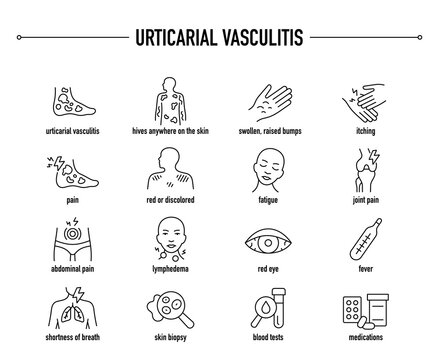 Urticarial Vasculitis symptoms, diagnostic and treatment vector icon set