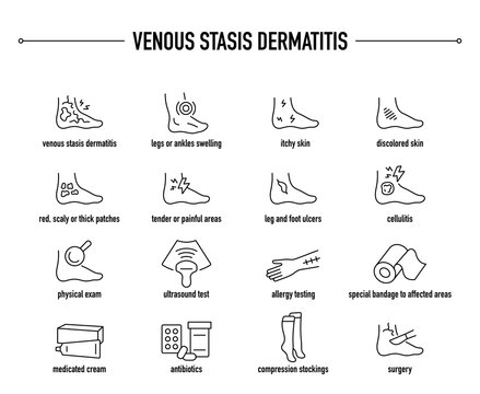 Venous Stasis Dermatitis symptoms, diagnostic and treatment vector icon set