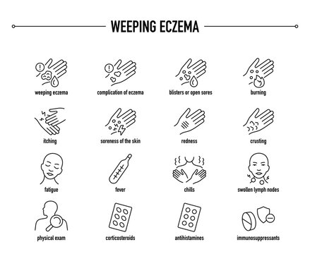 Weeping Eczema symptoms, diagnostic and treatment vector icon set