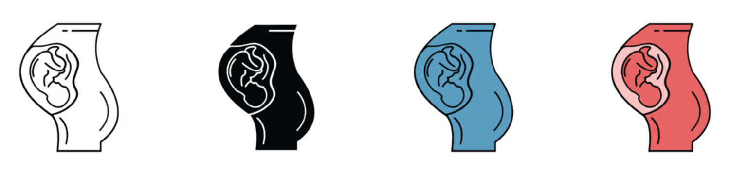 Pregnancy stages illustration set from first to third trimester and birth process vector