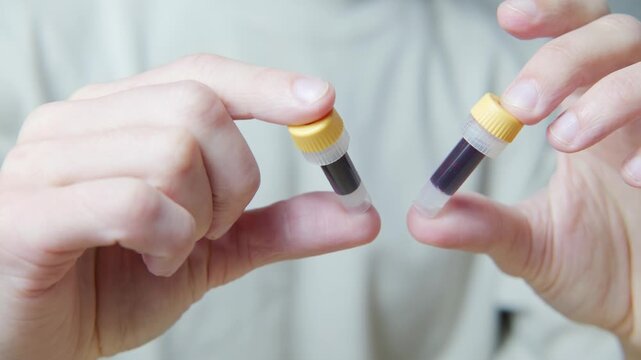 plastic test tubes with blood for analysis, Blood self-test procedure, showing finger prick step for personal health monitoring, convenience and accessibility at-home health diagnostics