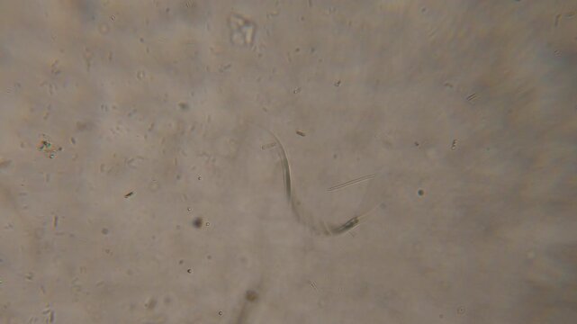 Bacteria Parasites and Worms in drinking Water under Microscope. nematode Worm under Microscope, Parasites Among Roundworms: Roundworms, Pinworms, Trichinella. Environmental Pollution.