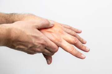Hand pain, close-up of male hands on a white background
