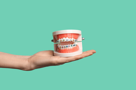Female hand holding model of jaw with dental braces on green background