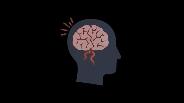 Animated video illustrating brain pain, stroke, or cerebrovascular disease concept for medical awareness and health education