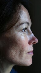 Obraz premium Woman's face in profile showing natural skin aging, hyperpigmentation, melasma, dark spots, and sun damage, highlighting dermatology, skin health, and beauty care concerns