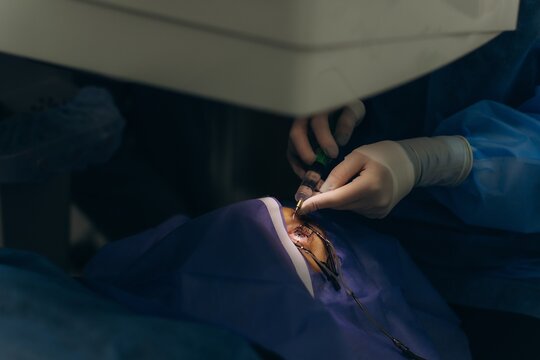 Surgeon performing eye operation during refractive surgery