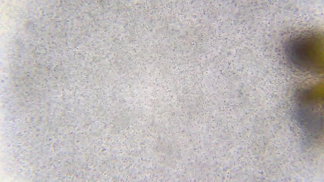 Dense population of active bacteria with several ciliates visible under 400x brightfield microscopy. 4K scientific footage of dynamic microbial community.