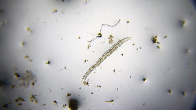 Segmented worm crawling under 40x brightfield microscopy. Detailed 4k microscopic view of an active annelid moving across the substrate.