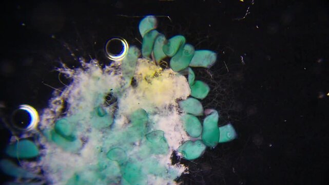 Large colony of Stentor ciliates hunting bacteria under 400x darkfield microscopy. Detailed 4k microscopic view of active protozoan feeding behavior.