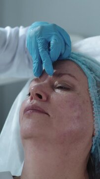 Beauty injections for an adult woman - injecting in the bridge of the nose