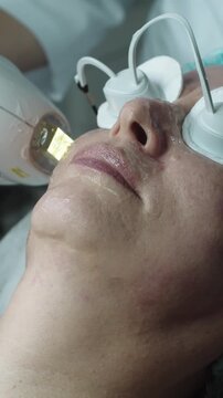 HIFU treatment for adult woman