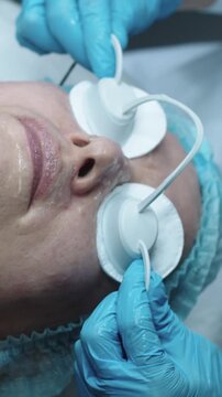 Cosmetology treatment - the doctor puts protective discs on the patient's eyes before the procedure