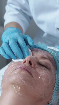 Cosmetology treatment - the doctor puts cotton pads on the patient's eyes before the procedure