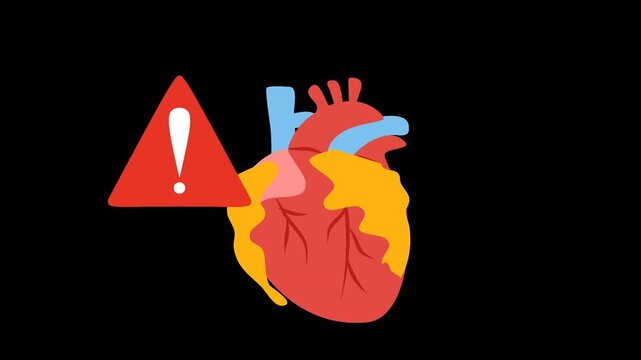 Coronary artery disease medical illustration. Heart blockage and atherosclerosis animation
