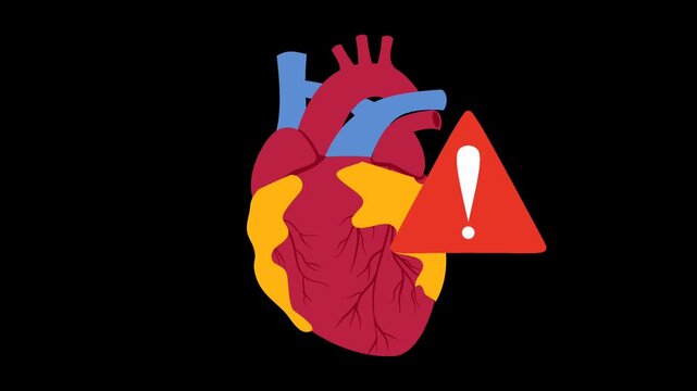 Coronary artery disease medical illustration. Heart blockage and atherosclerosis animation