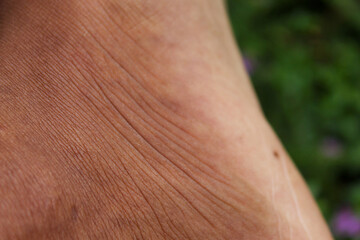 Fototapeta premium macro detail of man's leg skin texture with fine lines and pores