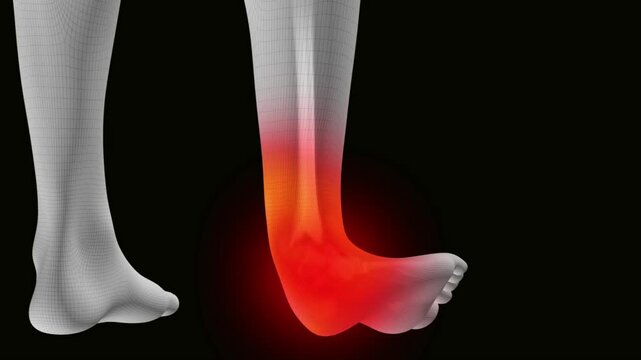 Pain and edema in the sprained ankle. Ankle Pain Affecting Mobility and Daily Activities. Ankle injury with dislocation and sprains.