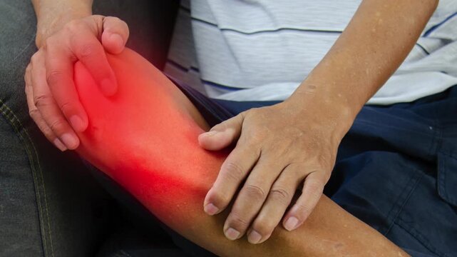 Knee Pain Affecting Mobility and Daily Activities. Knee injury with dislocation and sprains. Pain and edema in the sprained Knee.