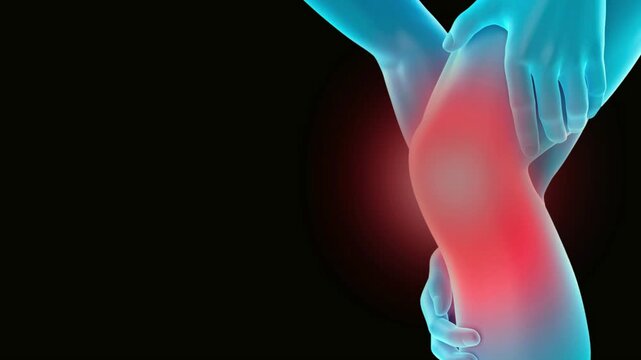 Knee Pain Affecting Mobility and Daily Activities. Knee injury with dislocation and sprains. Pain and edema in the sprained Knee.