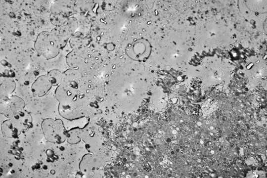 Bubbles and Droplets in Black and White Under a Microscope View