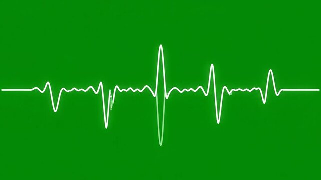 ECG heartbeat waveform on green background, medical rhythm illustration for presentation or website, overlay effect, Isolated on transparent background, png