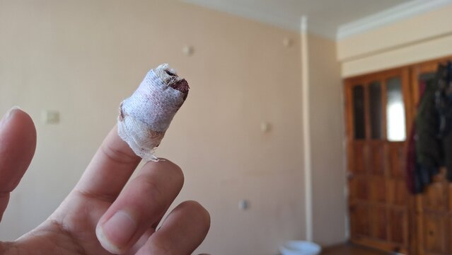 Izmir, Turkiye - 02 02 2026: Bandaged Finger Close Up Indoors, Close-up of a hand with a finger wrapped in a bandage, representing minor everyday injury or personal care at home