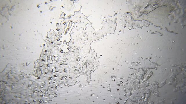 Three live, actively moving Demodex brevis and Demodex folliculorum mites under 40x brightfield microscopy. Detailed 4K scientific stock footage of microscopic parasite activity.