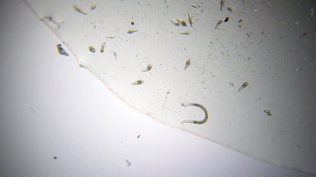 Nematode surrounded by rotifers at the edge of a water droplet under 40x brightfield microscopy. Detailed 4K scientific stock footage of mixed freshwater microfauna.